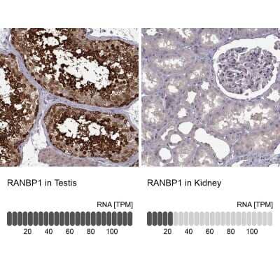 Immunohistochemistry-Paraffin: RanBP1 Antibody [NBP2-57339]