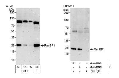 Immunoprecipitation: RanBP1 Antibody [NB100-79815]