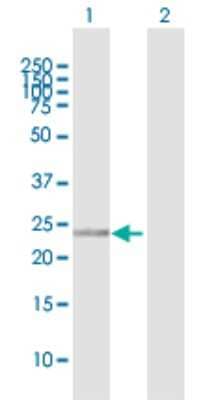 Western Blot: RanBP1 Antibody [H00005902-D01P]