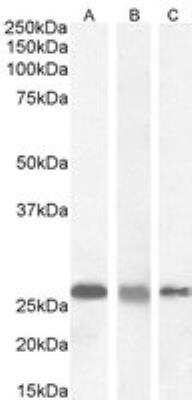 Western Blot: RanBP1 Antibody [NB100-1443]