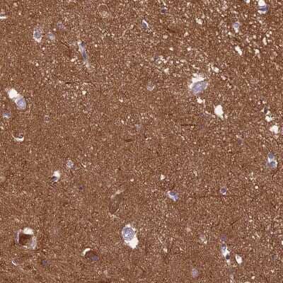 Immunohistochemistry-Paraffin: RanBP16 Antibody [NBP2-48800]