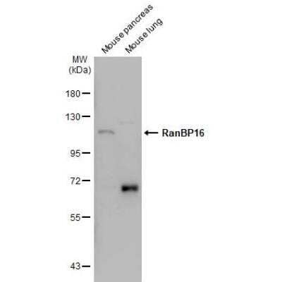 Western Blot: RanBP16 Antibody [NBP1-32350]