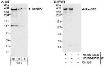 Western Blot: RanBP2 Antibody [NB100-93337]