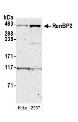 Western Blot: RanBP2 Antibody [NB100-93337]