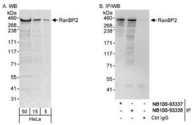 Western Blot: RanBP2 Antibody [NB100-93338]