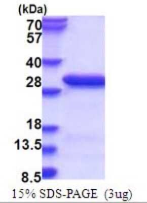 SDS-PAGE: Recombinant Human RanBP3 His Protein [NBP2-51726]