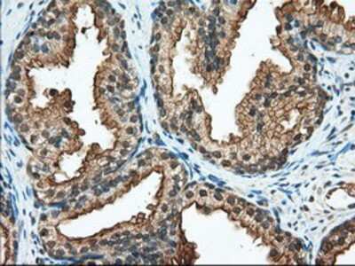 Immunohistochemistry-Paraffin: RanGAP1 Antibody (OTI1B4) [NBP2-02623]