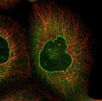 Immunocytochemistry/ Immunofluorescence: RanGAP1 Antibody [NBP2-33591]