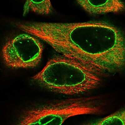 Immunocytochemistry/ Immunofluorescence: RanGAP1 Antibody [NBP2-56215]