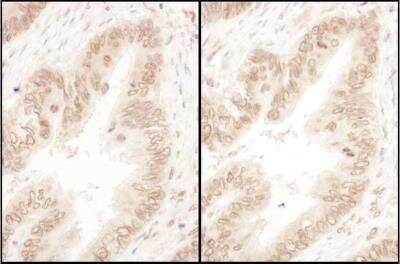Immunohistochemistry: RanGAP1 Antibody [NBP1-18915]