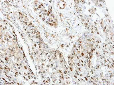 Immunohistochemistry-Paraffin: RanGAP1 Antibody [NBP2-20067]