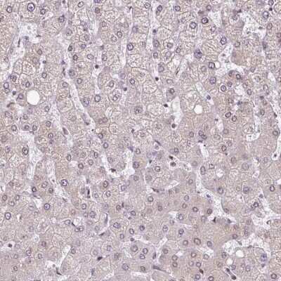 Immunohistochemistry-Paraffin: RanGAP1 Antibody [NBP2-33591]