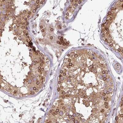 Immunohistochemistry-Paraffin: RanGAP1 Antibody [NBP2-33591]