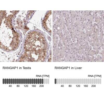 Immunohistochemistry-Paraffin: RanGAP1 Antibody [NBP2-33591]