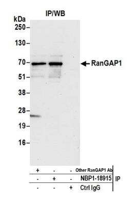 Immunoprecipitation: RanGAP1 Antibody [NBP1-18915]