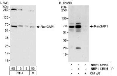 Western Blot: RanGAP1 Antibody [NBP1-18915]