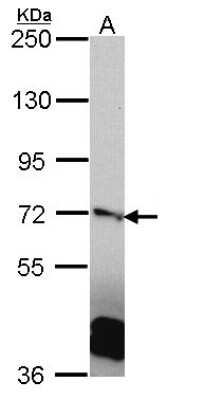 Western Blot: RanGAP1 Antibody [NBP2-20067]