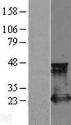 Western Blot: Rap2A Overexpression Lysate [NBL1-15148]