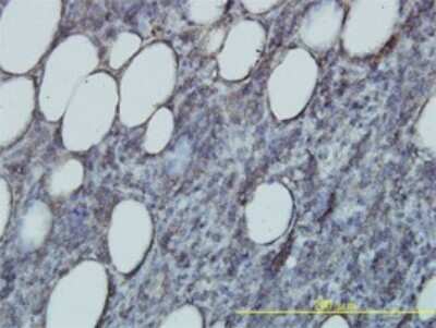 Immunohistochemistry-Paraffin: Rap2B Antibody (4F12-3C6) [H00005912-M01]