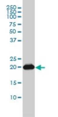 Western Blot: Rap2B Antibody (4F12-3C6) [H00005912-M01]