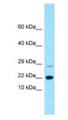 Western Blot: Rap2B Antibody [NBP1-98510]