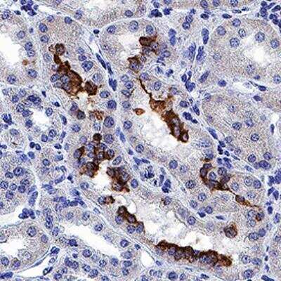 Immunohistochemistry: Rapid DAB Staining Kit (Colorimetric) [NBP3-18633]