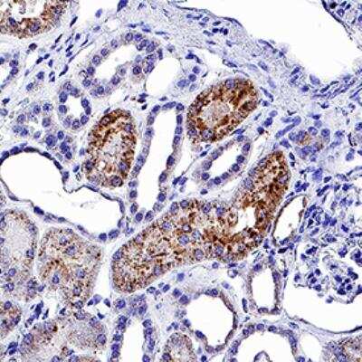 Immunohistochemistry: Rapid DAB Staining Kit (Colorimetric) [NBP3-18633]
