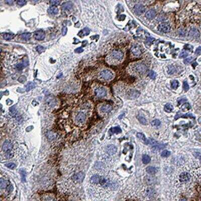 Immunohistochemistry: Rapid DAB Staining Kit (Colorimetric) [NBP3-18633]