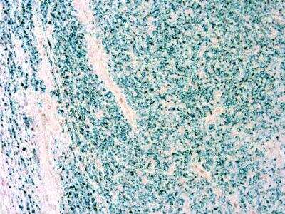 Immunohistochemistry-Paraffin: Rapid Tissue Preservation Solution [NBP3-12177]