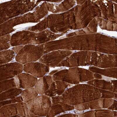 Immunohistochemistry-Paraffin: Rapsyn Antibody [NBP1-85537]