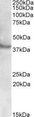 Western Blot: Rapsyn Antibody [NBP1-37778]