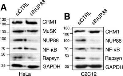 Western Blot: Rapsyn Antibody [NBP1-85537]