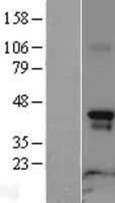 Western Blot: Rapsyn Overexpression Lysate [NBL1-15154]