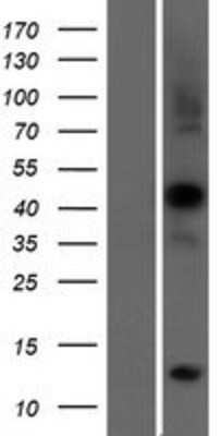 Western Blot: Rapsyn Overexpression Lysate [NBP2-10522]