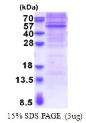 SDS-PAGE: Recombinant Mouse Rapsyn His Protein [NBP2-23403]