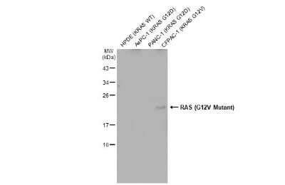 Western Blot: Ras AntibodyG12V Mutant [NBP3-13132]