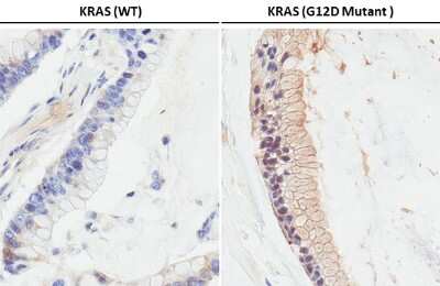Immunohistochemistry-Paraffin: Ras Antibody (HL10) - G12D Mutant [NBP3-13647]
