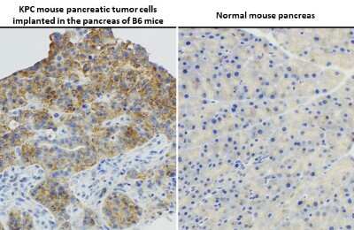 Immunohistochemistry-Paraffin: Ras Antibody (HL10) - G12D Mutant [NBP3-13647]