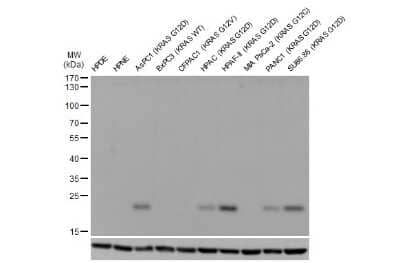 Western Blot: Ras Antibody (HL10)G12D Mutant [NBP3-13647]