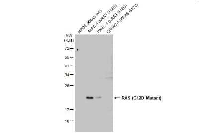 Western Blot: Ras Antibody (HL10)G12D Mutant [NBP3-13647]