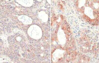 Immunohistochemistry-Paraffin: Ras Antibody (HL169) - G12V Mutant [NBP3-13668]