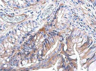 Immunohistochemistry-Paraffin: Ras Antibody [NBP2-43784]