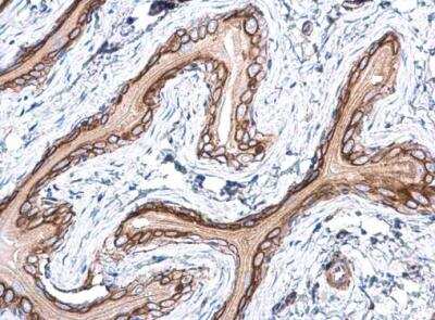Immunohistochemistry-Paraffin: Ras Antibody [NBP2-43784]