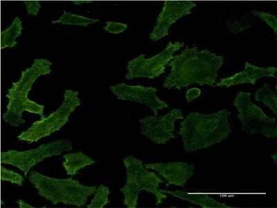 Immunocytochemistry/ Immunofluorescence: Ras-GAP Antibody (1E6) [H00005921-M03]