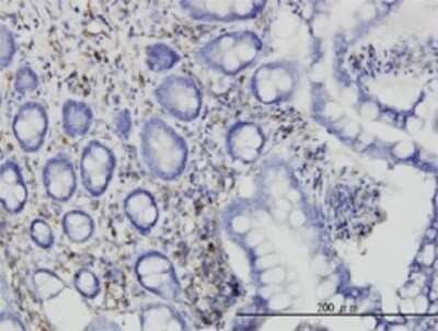 Immunohistochemistry-Paraffin: Ras-GAP Antibody (2C12) [H00005921-M01]