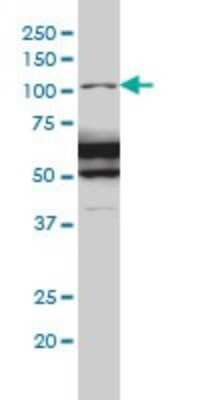 Western Blot: Ras-GAP Antibody (2C12) [H00005921-M01]