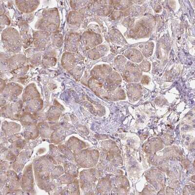 Immunohistochemistry-Paraffin: Ras-GAP Antibody [NBP2-55354]