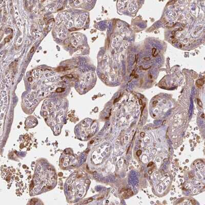 Immunohistochemistry-Paraffin: Ras-GAP Antibody [NBP2-55354]