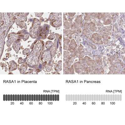 Immunohistochemistry-Paraffin: Ras-GAP Antibody [NBP2-55354]