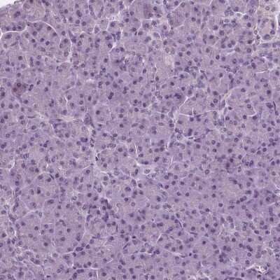 Immunohistochemistry-Paraffin: Ras-GAP Antibody [NBP2-56891]
